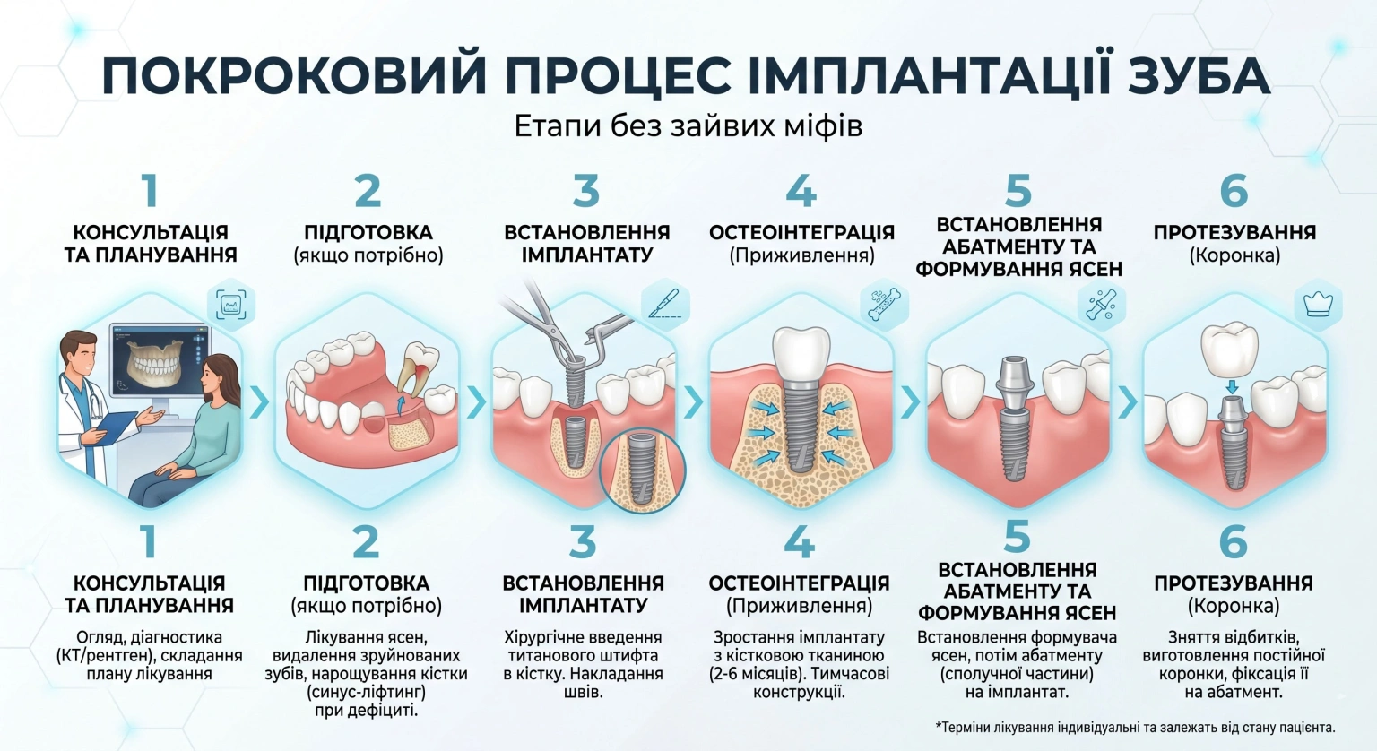 Як проходить імплантація зуба: послідовність без зайвих міфів